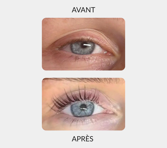 Sérum Fortificante para Cílios – Cílios Mais Longos, Mais Espessos e Naturais em 14 Dias