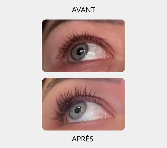 Sérum Fortificante para Cílios – Cílios Mais Longos, Mais Espessos e Naturais em 14 Dias