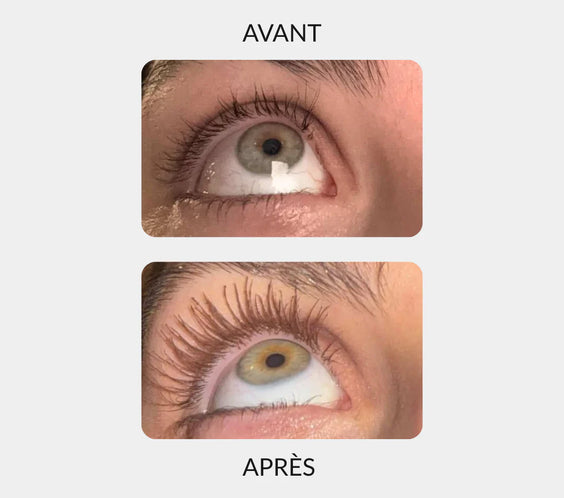 Sérum Fortificante para Cílios – Cílios Mais Longos, Mais Espessos e Naturais em 14 Dias